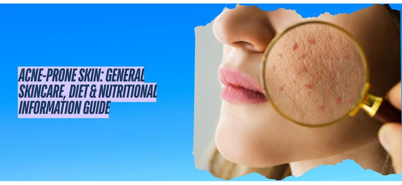 Acne-Prone Skin: General Skincare, Diet & Nutritional Information Guide
