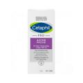 Cetaphil Pro Acne Prone Oil Free Moisturising Lotion SPF25 118ml